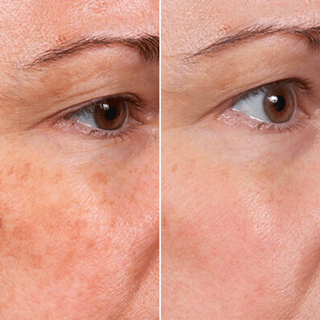 𝑷𝒖𝒓𝒆𝒍𝒖𝒙𝒐® 🇺🇸 Stem Cell–Inspired & GHK-Cu Powered Wrinkle-Refining Serum（Advanced Anti-Aging for Timeless, Radiant Skin） - Image 8